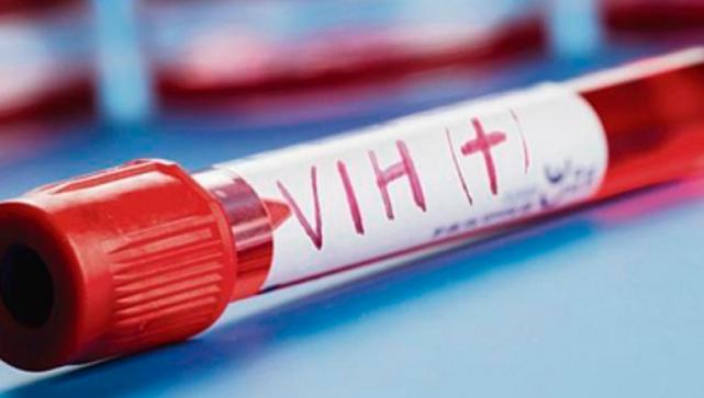 VIH Virus de la Inmunodeficiencia Humana